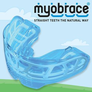 myobrace expanders