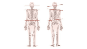 tmj bad posture link