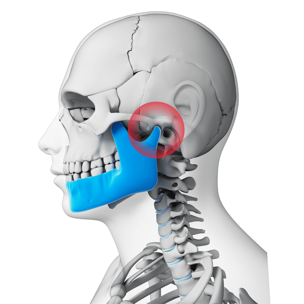 tmj causes neck and back pain