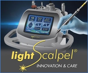 lightscalpel laser tongue tie release